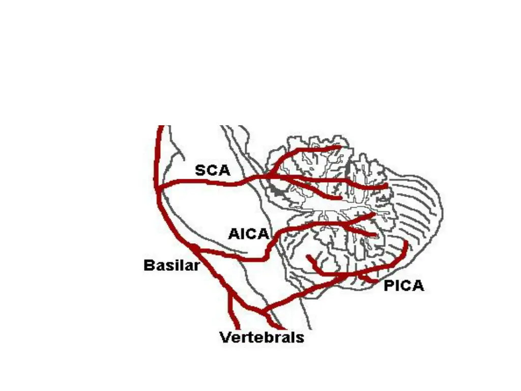 slide14