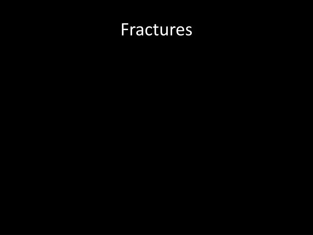 fractures