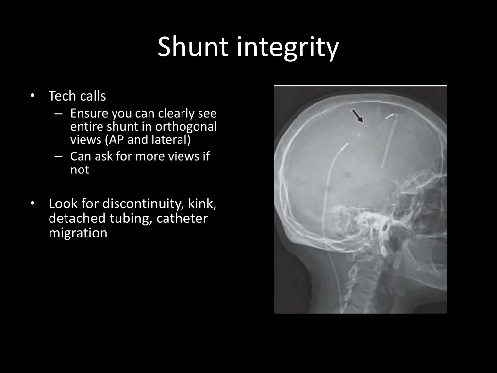 shunt integrity
