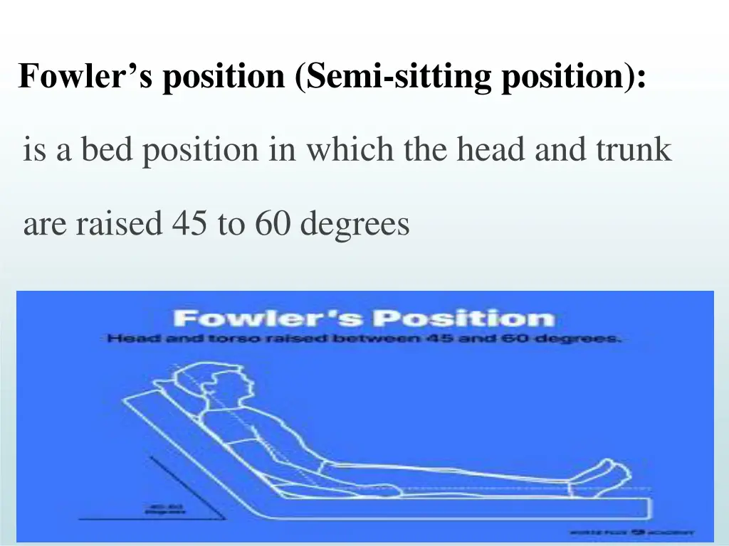 fowler s position semi sitting position