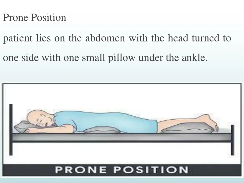 prone position