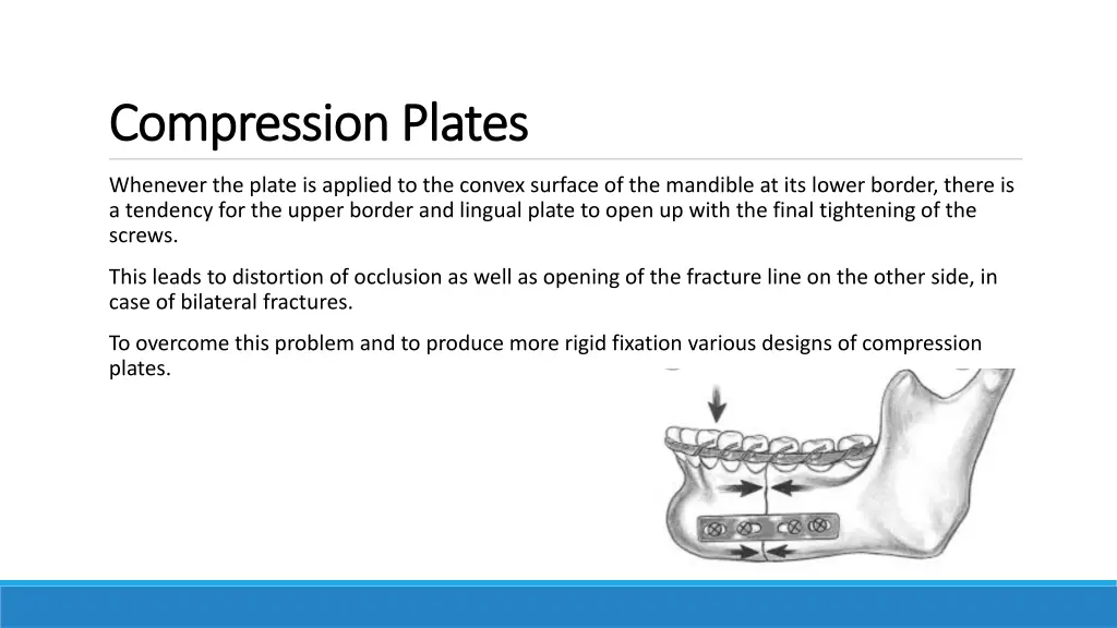 compression plates compression plates