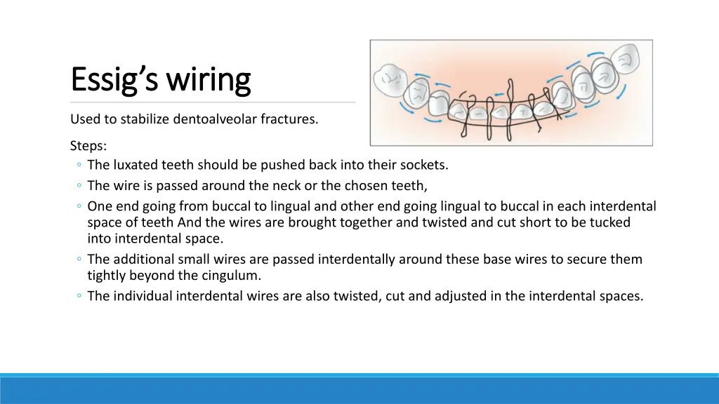 essig s wiring essig s wiring
