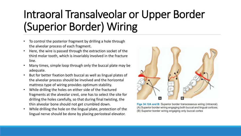 intraoral intraoral transalveolar transalveolaror