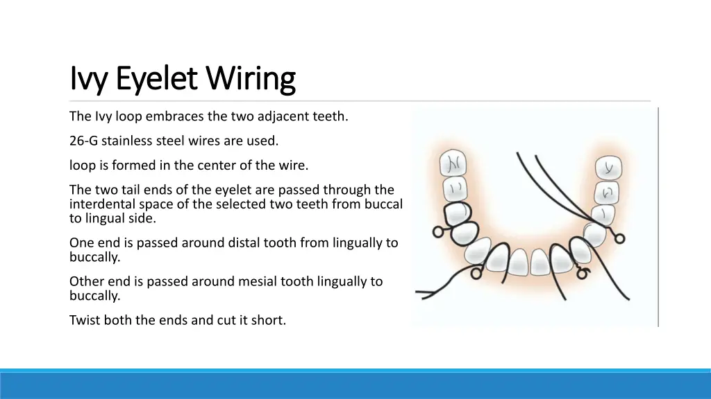 ivy eyelet wiring ivy eyelet wiring