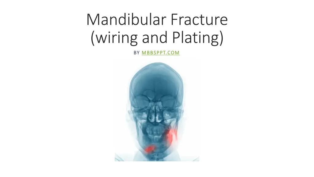 mandibular fracture wiring and plating
