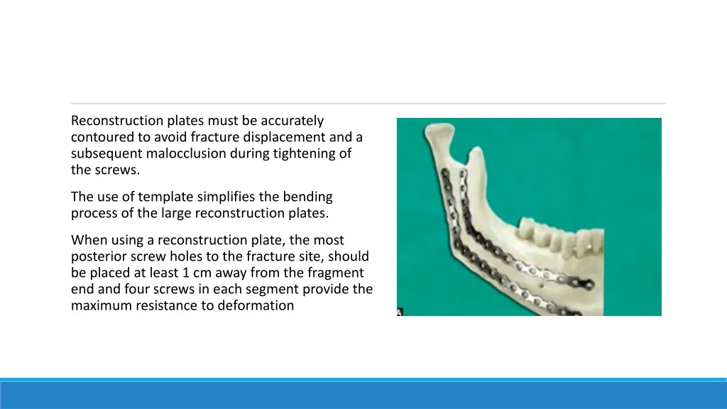reconstruction plates must be accurately
