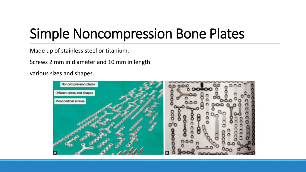simple simple noncompression noncompression bone