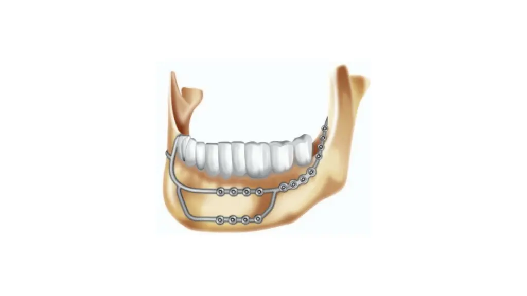 slide21