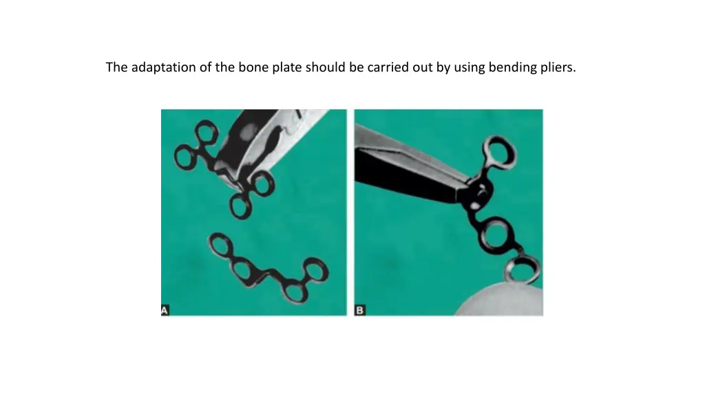 the adaptation of the bone plate should