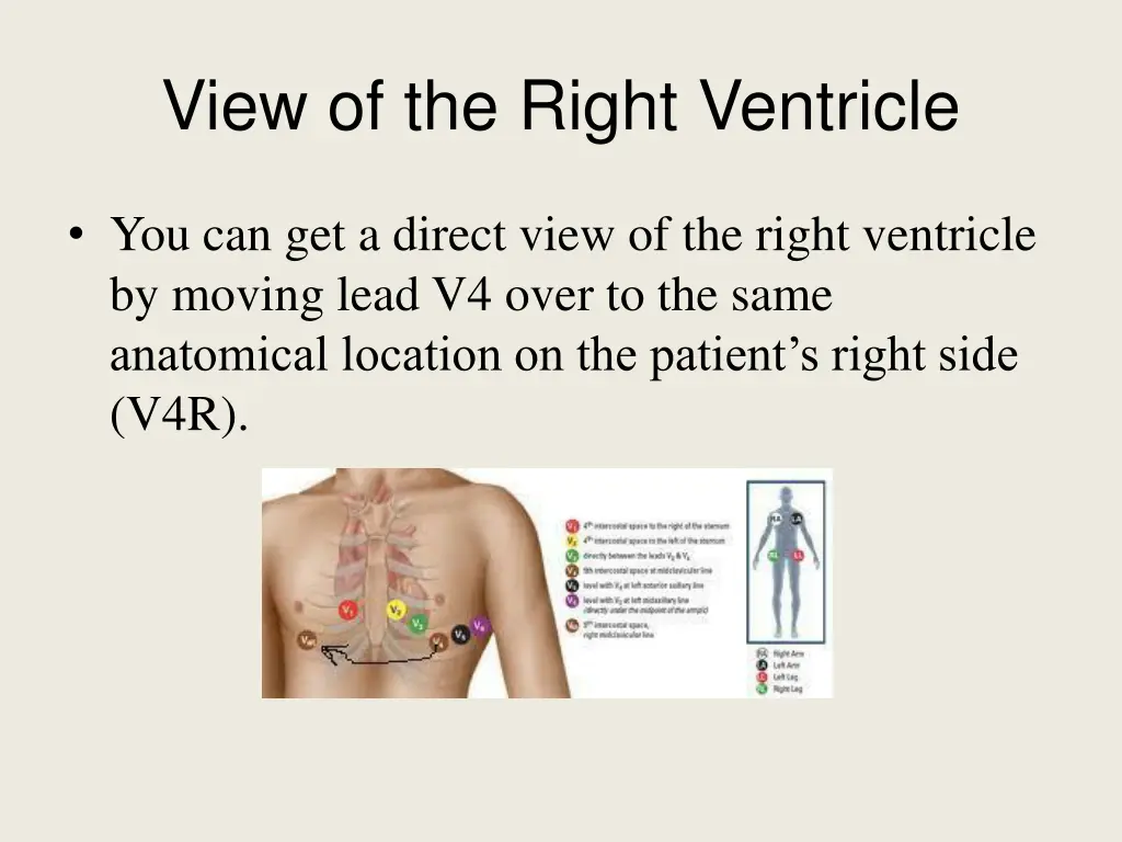 view of the right ventricle