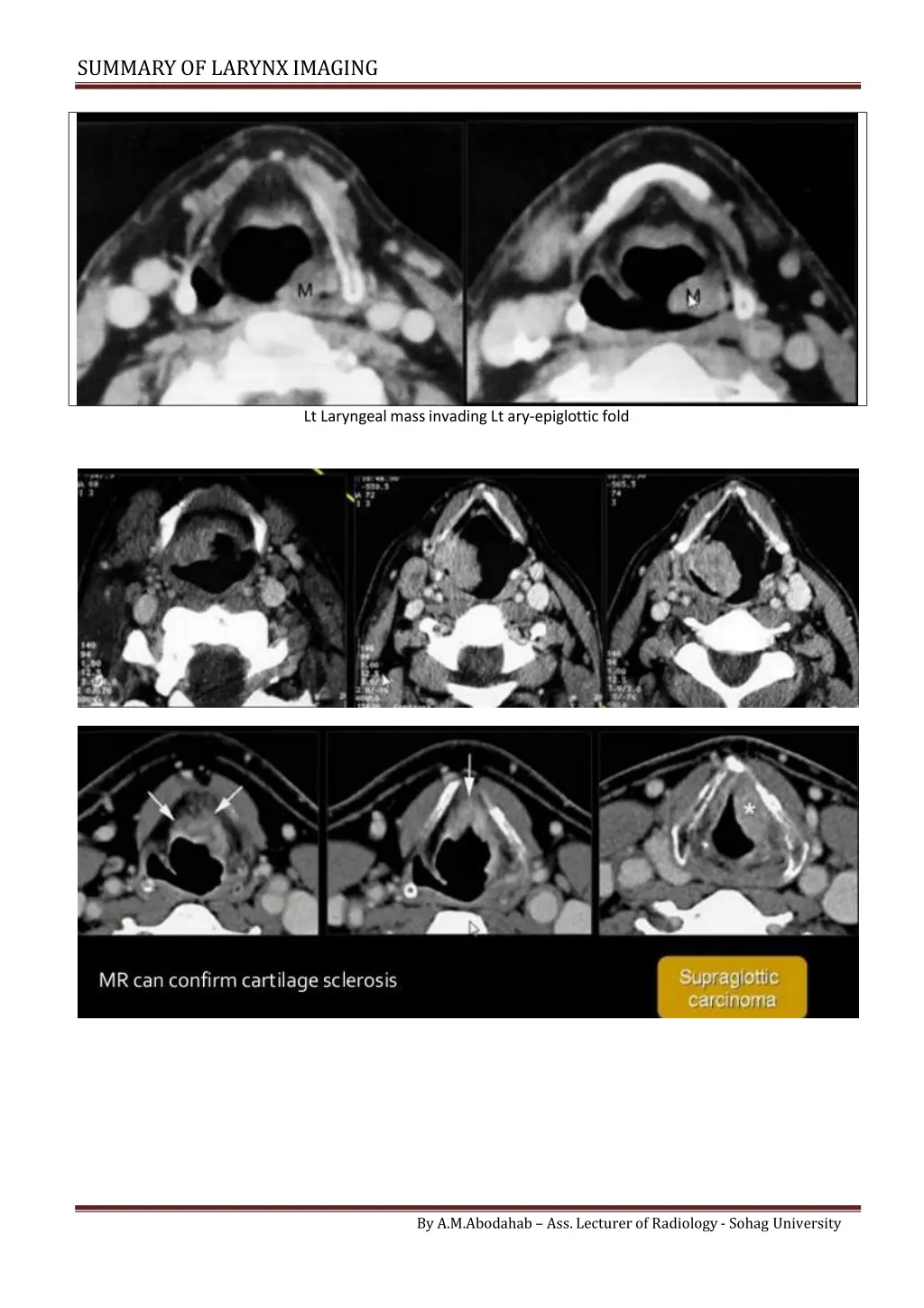 summary of larynximaging 2