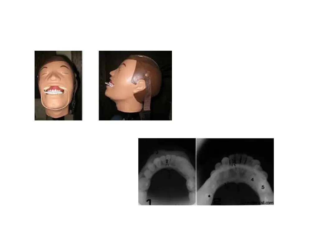 slide18