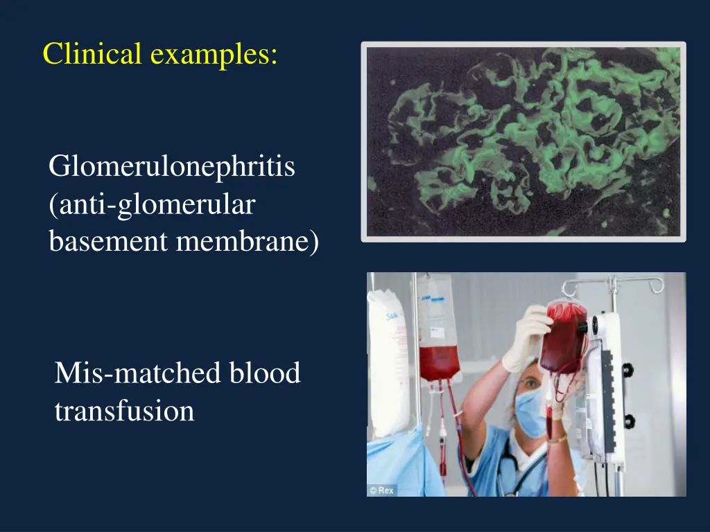 clinical examples