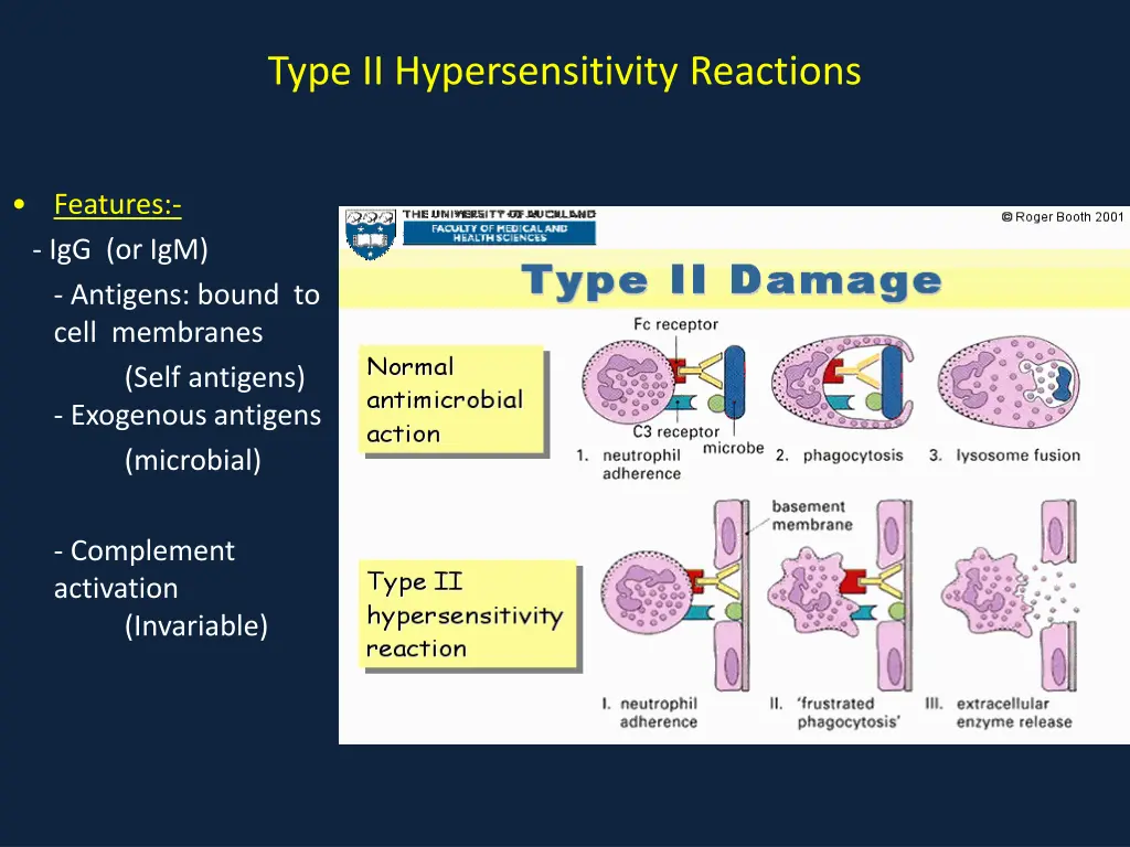 type ii hypersensitivity reactions