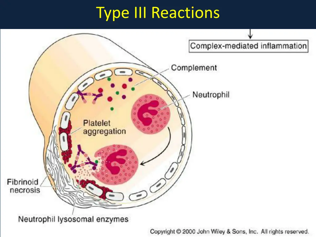 type iii reactions