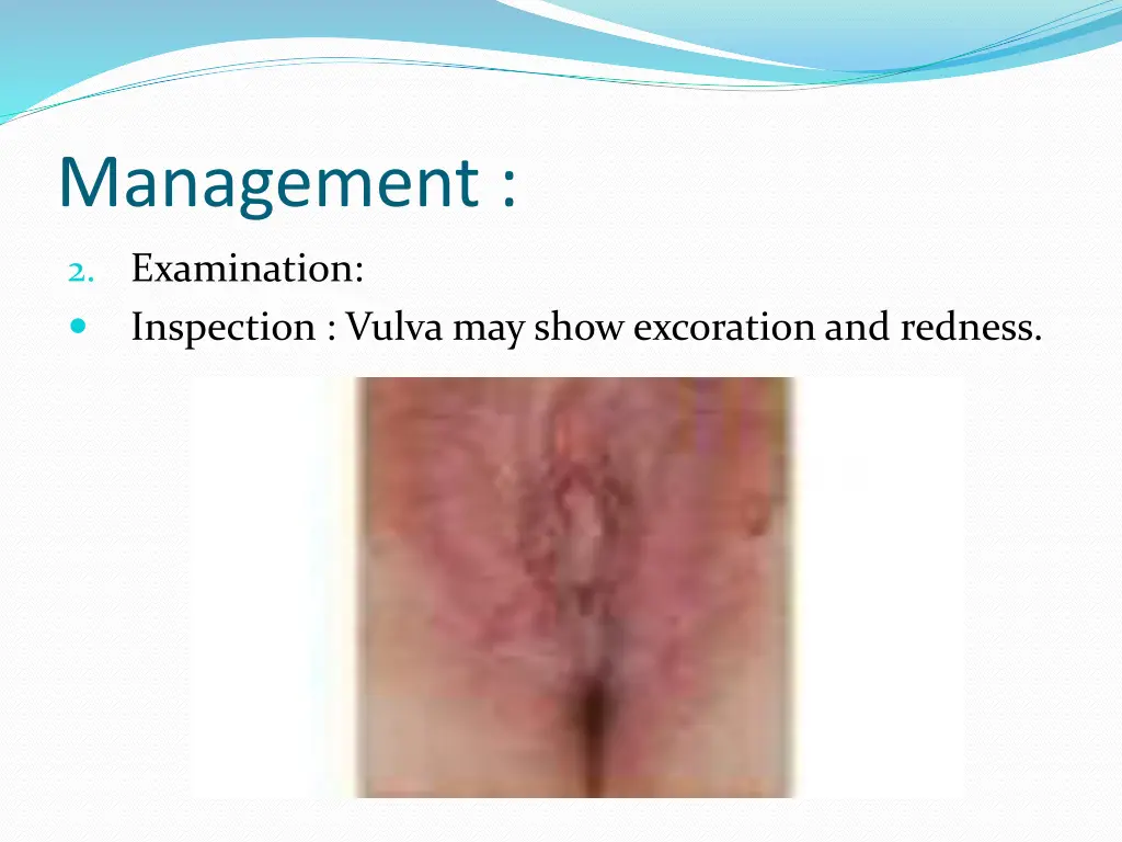 management