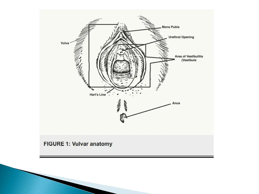slide10