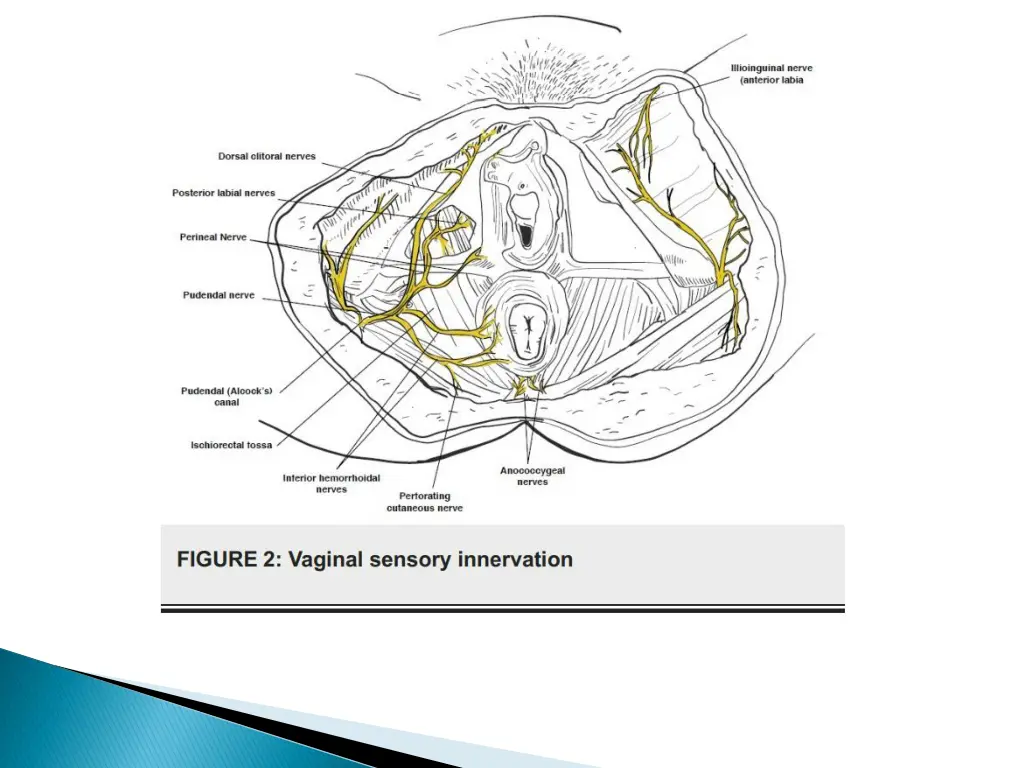 slide11