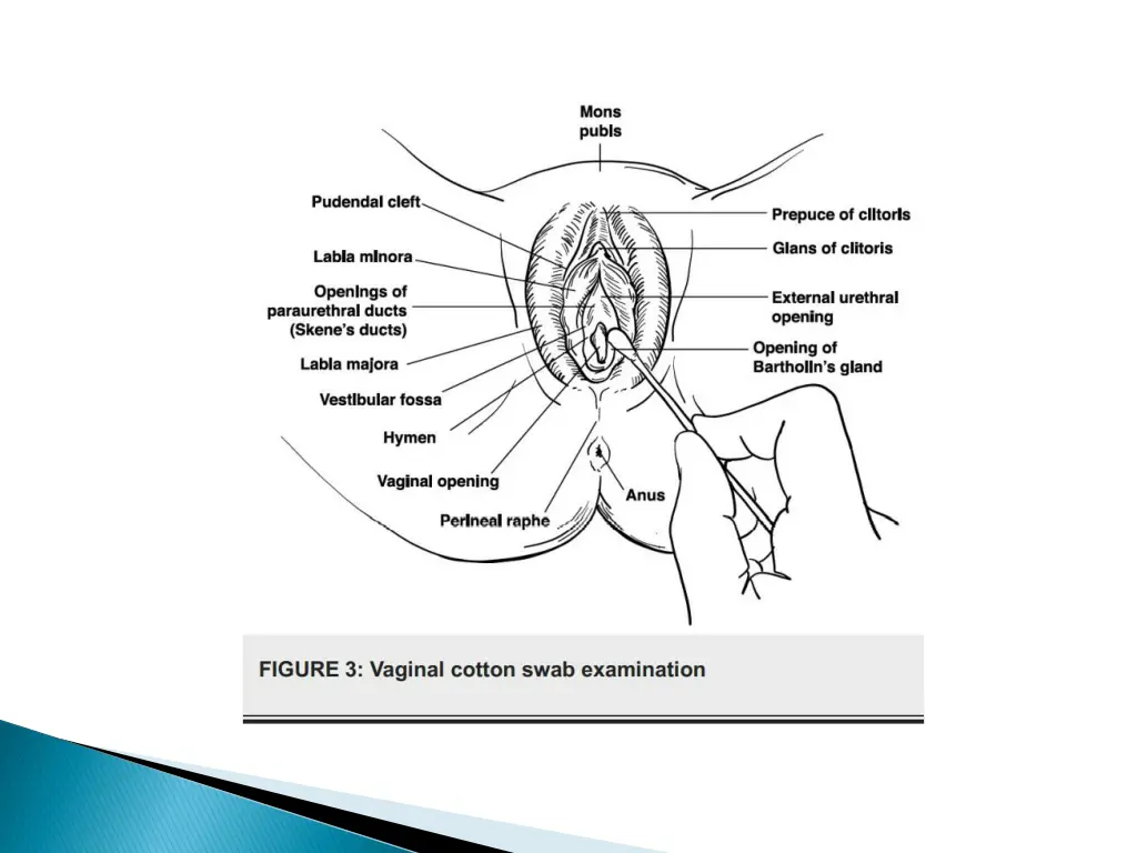 slide12