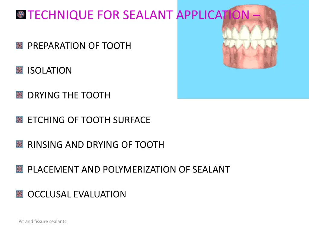 technique for sealant application
