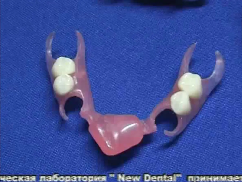 slide13