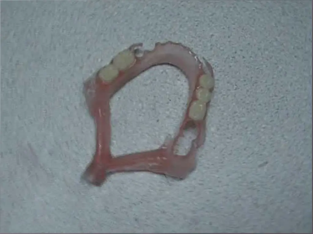 slide16