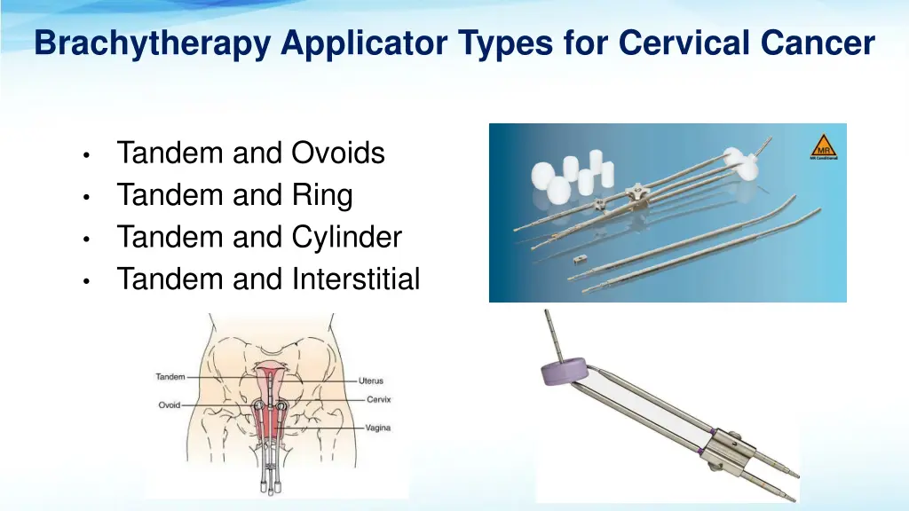 brachytherapy applicator types for cervical cancer