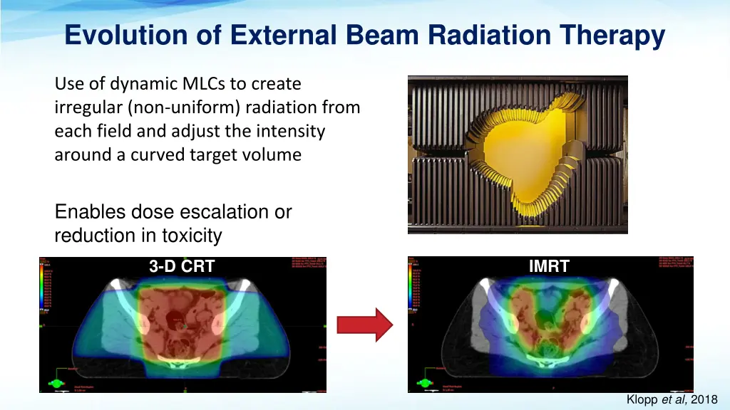 evolution of external beam radiation therapy 2