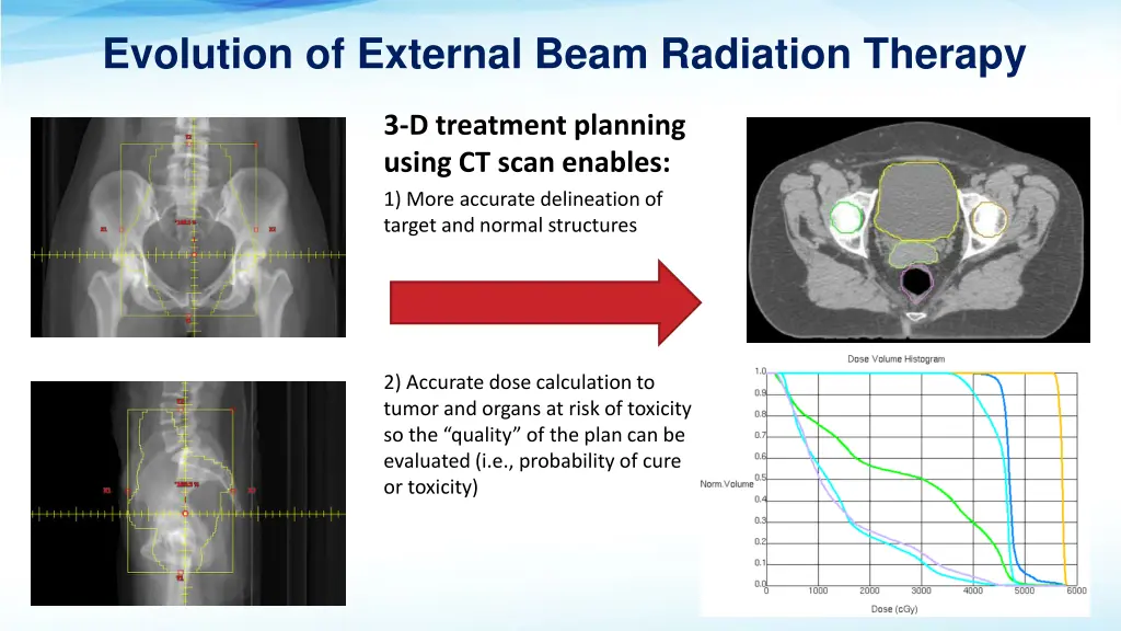 evolution of external beam radiation therapy