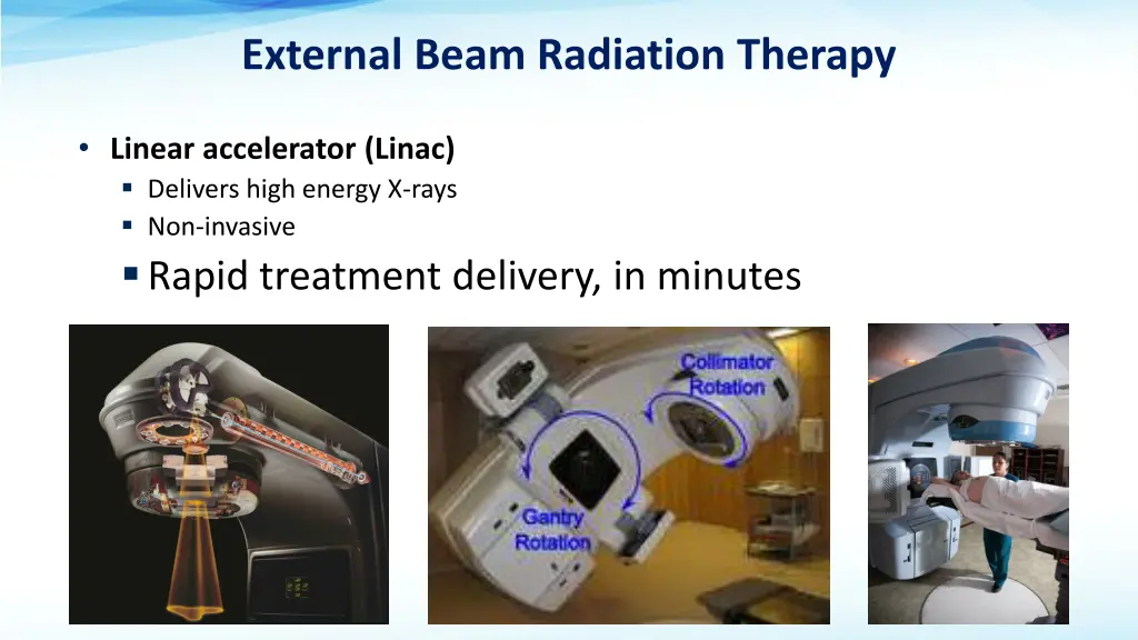external beam radiation therapy
