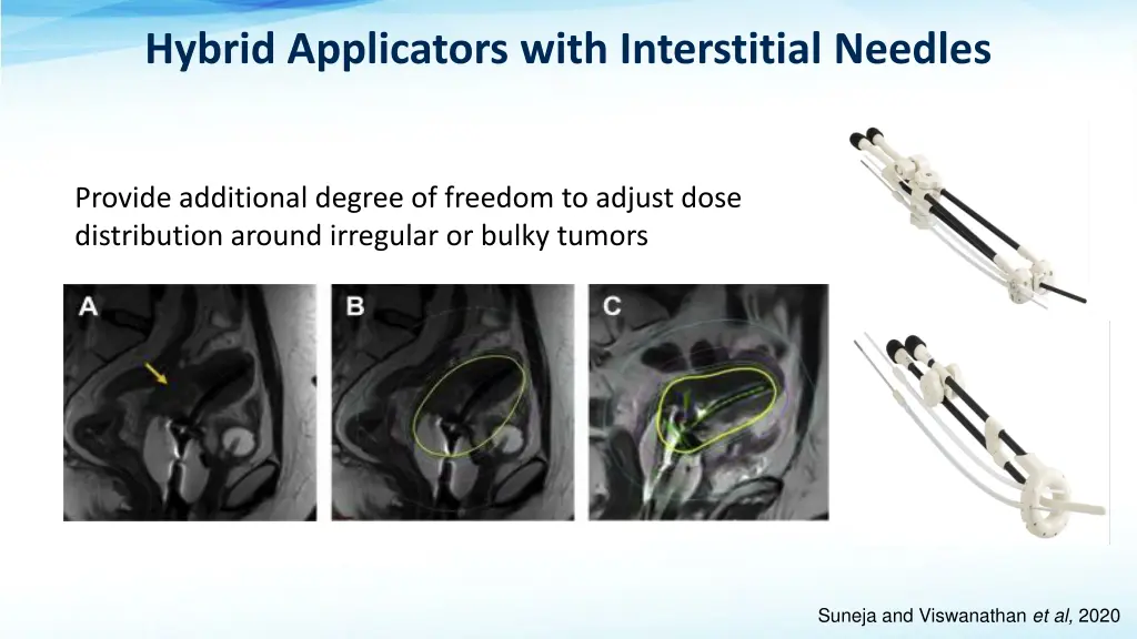 hybrid applicators with interstitial needles