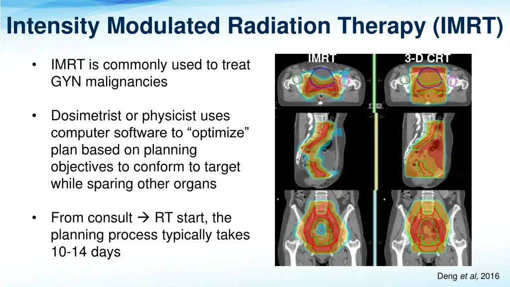 intensity modulated radiation therapy imrt