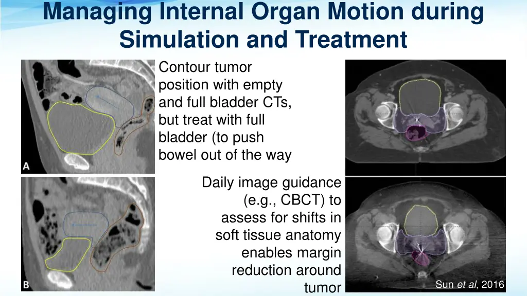 managing internal organ motion during simulation