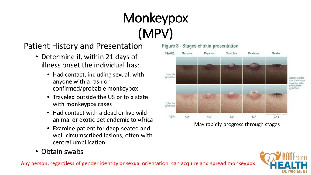monkeypox monkeypox mpv mpv 1