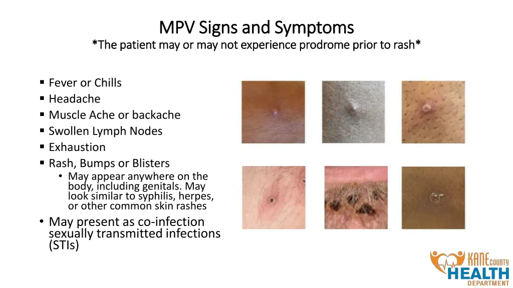 mpv signs and symptoms mpv signs and symptoms