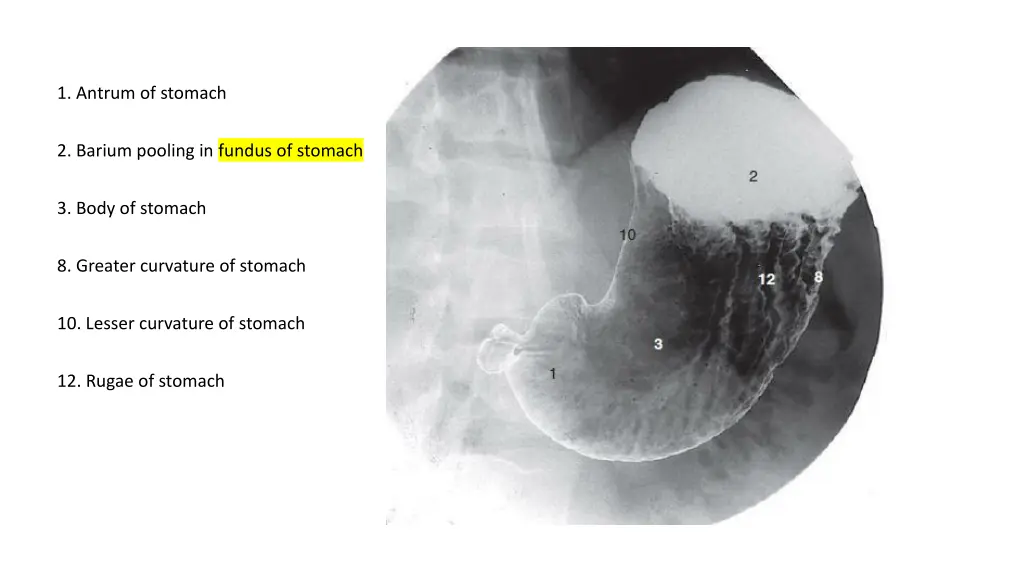 1 antrum of stomach