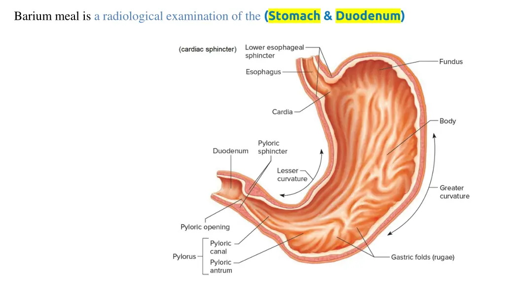 barium meal is a radiological examination