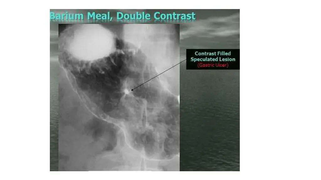 slide7