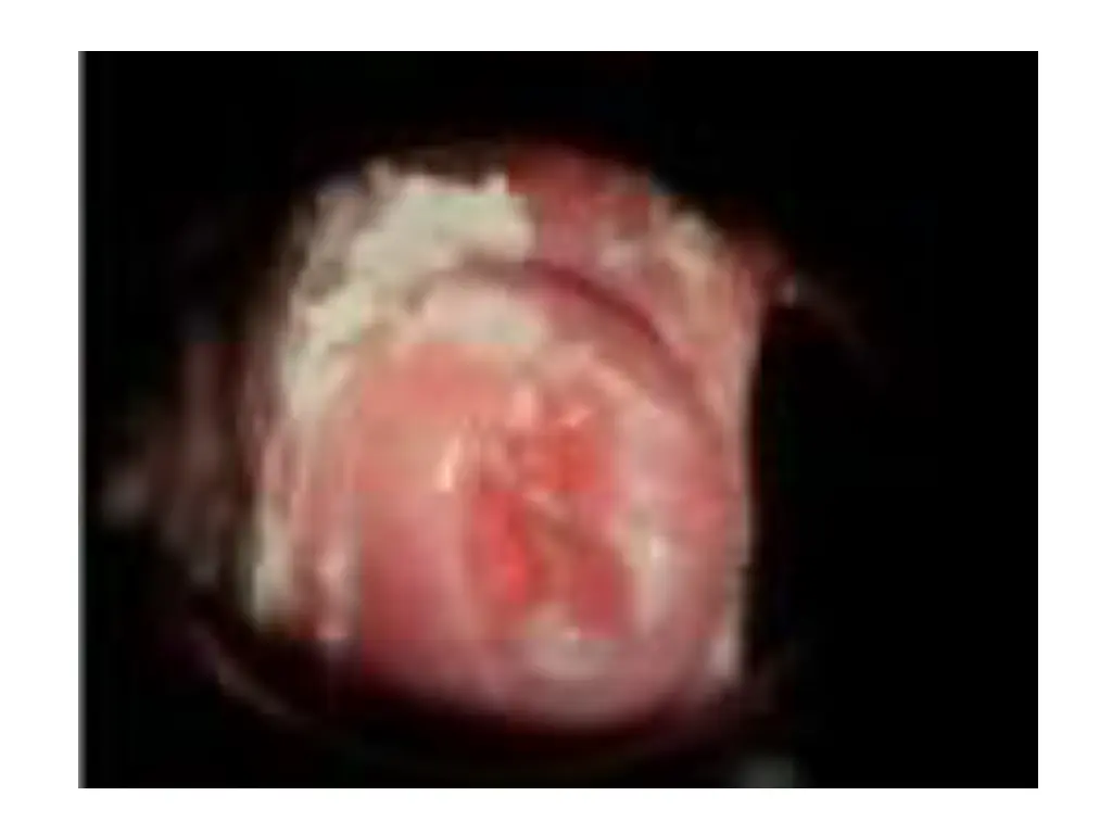 slide25