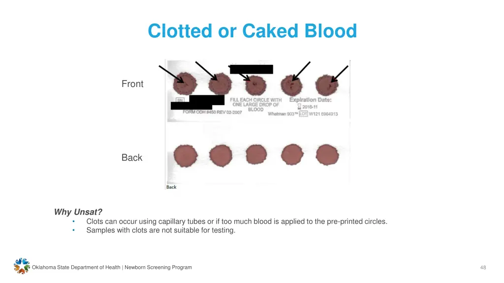 clotted or caked blood