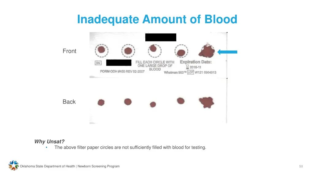 inadequate amount of blood