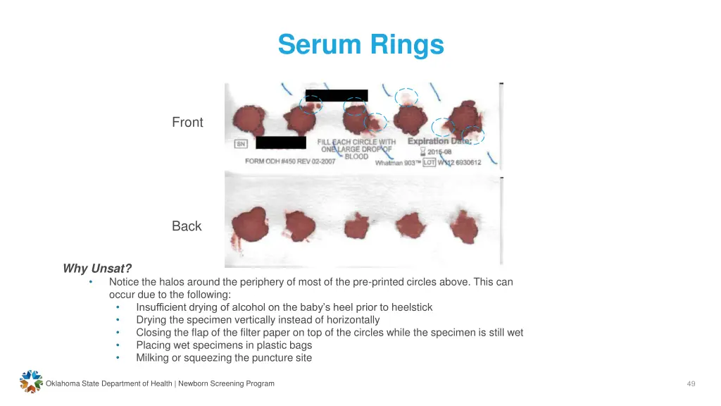 serum rings