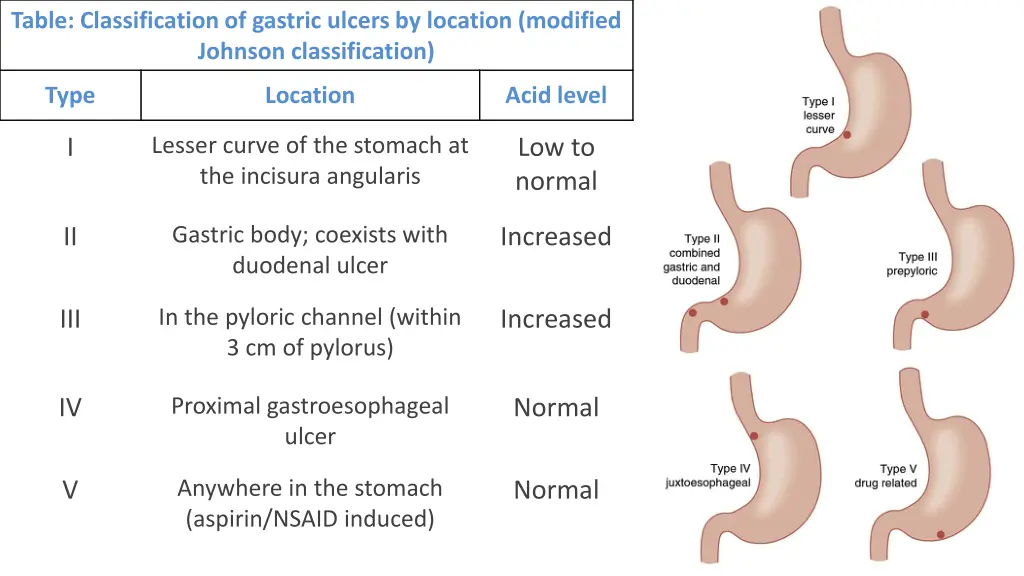 table classification of gastric ulcers