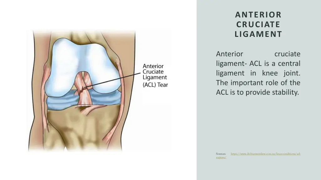 anterior cruciate ligament