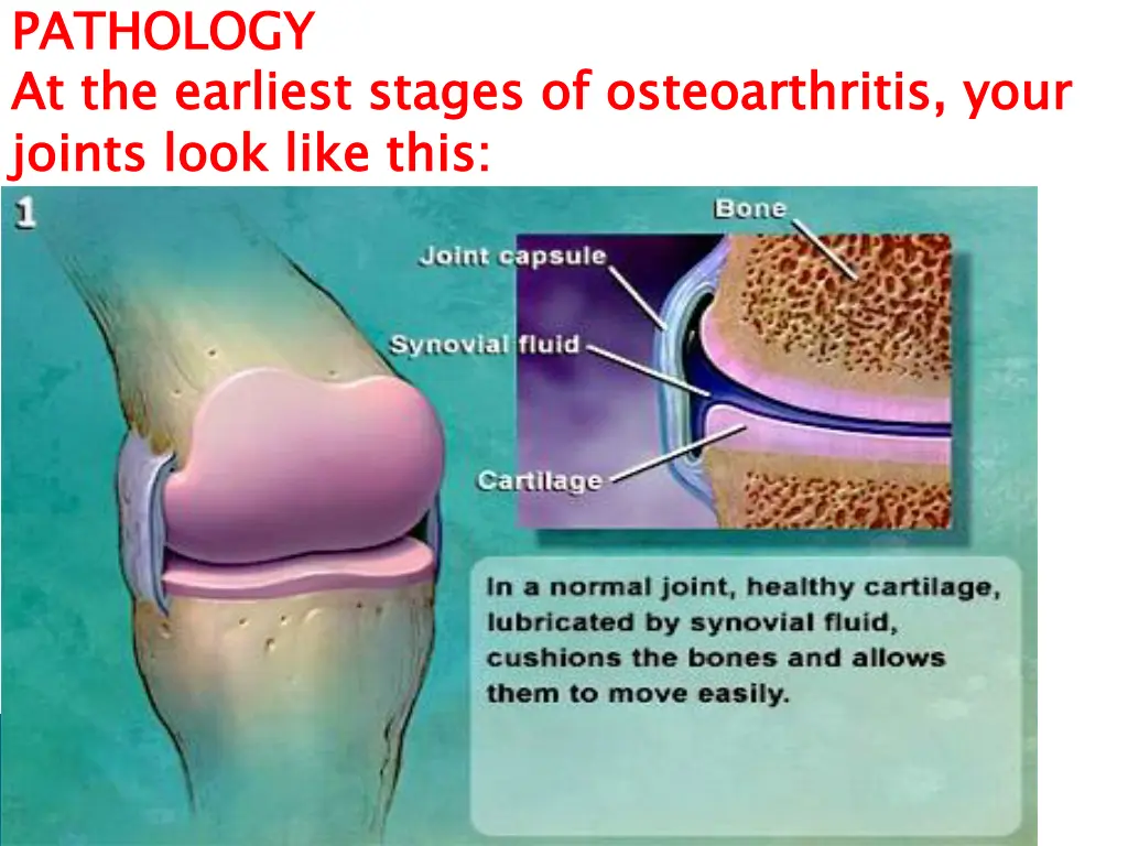 pathology at the earliest stages