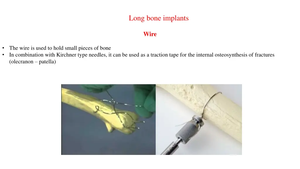 long bone implants 1