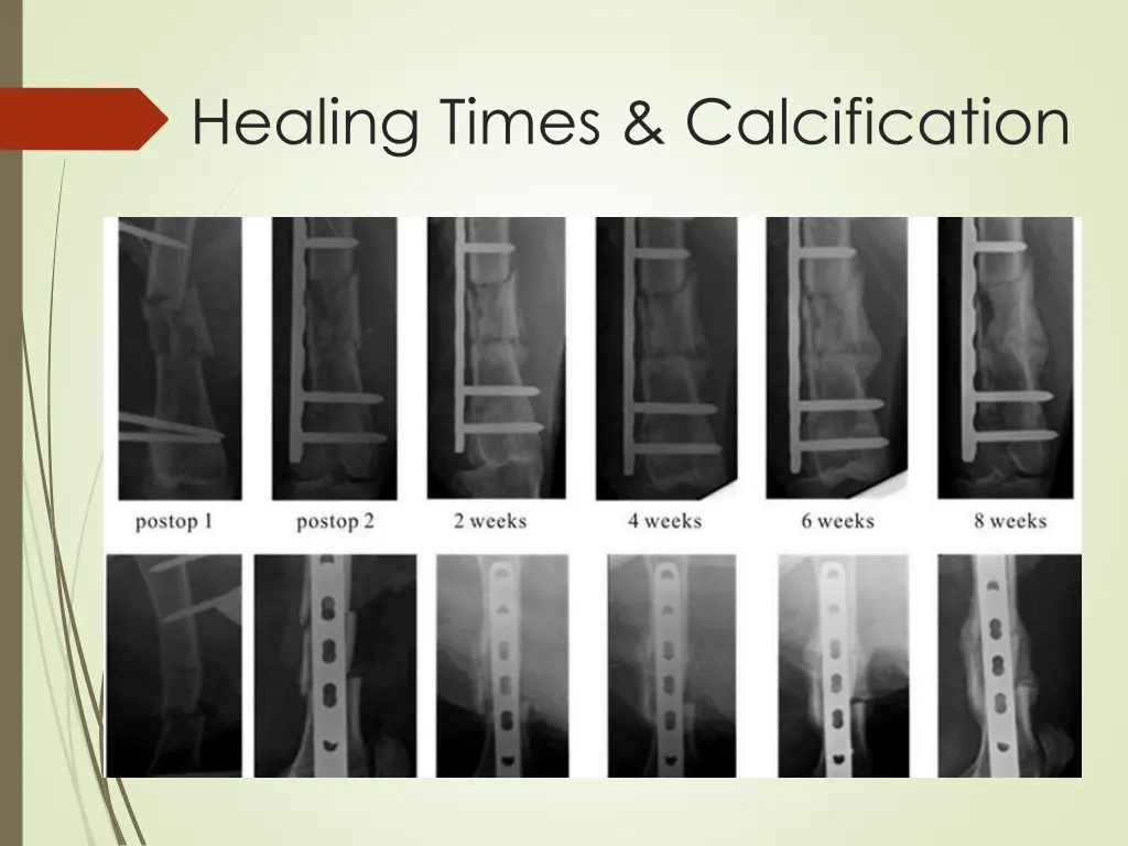 healing times calcification