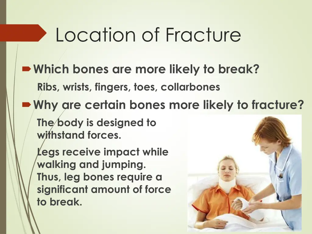 location of fracture