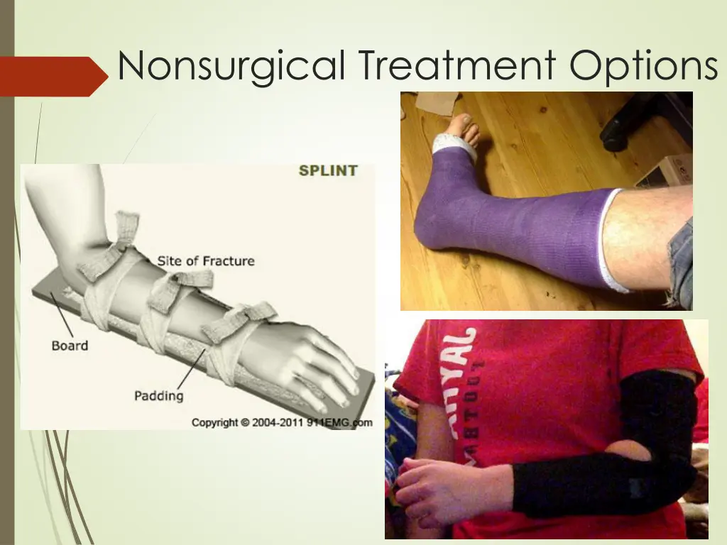 nonsurgical treatment options